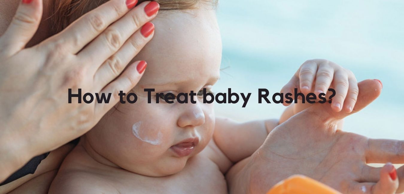 How to Treat baby Rashes?
